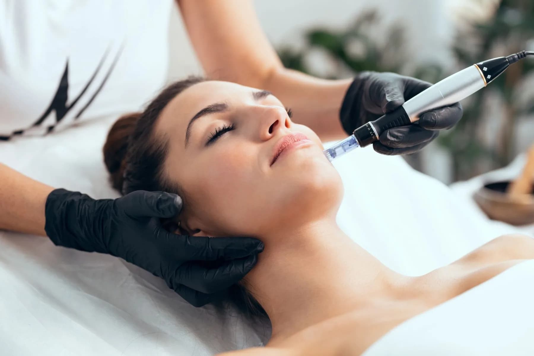 A clinician performing a microneedling treatment with a handheld device